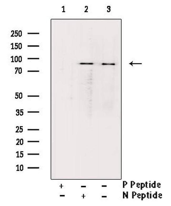 Phospho-Glucocorticoid Receptor (Ser226) Antibody in Western Blot (WB)