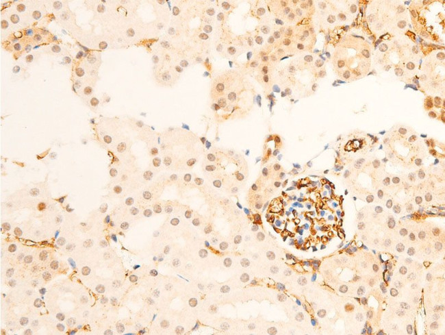 Phospho-TK1 (Ser13) Antibody in Immunohistochemistry (Paraffin) (IHC (P))