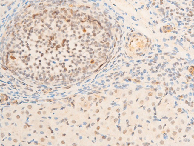 Phospho-TK1 (Ser13) Antibody in Immunohistochemistry (Paraffin) (IHC (P))