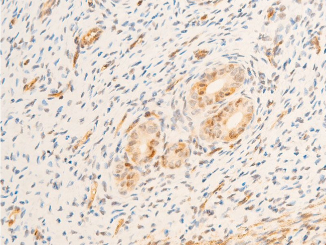 Phospho-TK1 (Ser13) Antibody in Immunohistochemistry (Paraffin) (IHC (P))