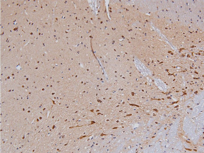 Phospho-Tyrosine Hydroxylase (Ser40) Antibody in Immunohistochemistry (Paraffin) (IHC (P))