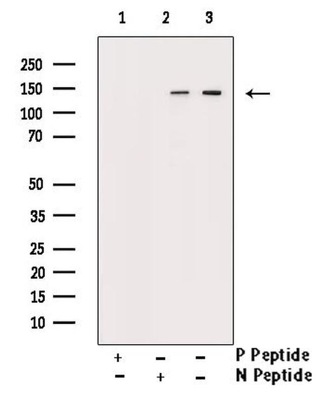 Phospho-Bcr (Tyr360) Antibody in Western Blot (WB)