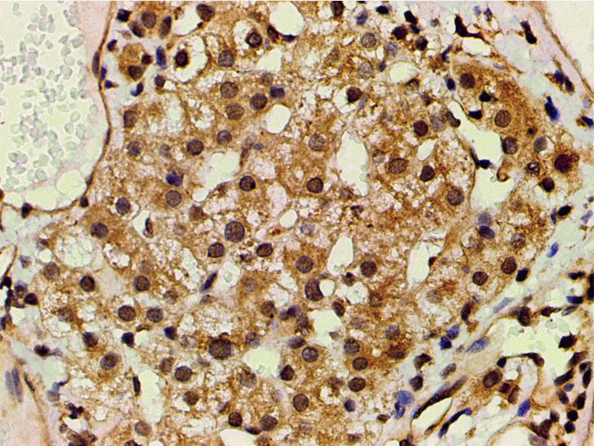 Phospho-PI3K p85 alpha (Tyr607) Antibody in Immunohistochemistry (Paraffin) (IHC (P))