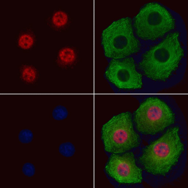 Phospho-IRS1 (Ser636) Antibody in Immunocytochemistry (ICC/IF)