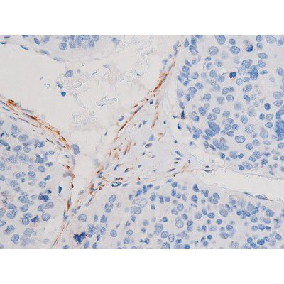 Phospho-IRS1 (Ser636) Antibody in Immunohistochemistry (Paraffin) (IHC (P))