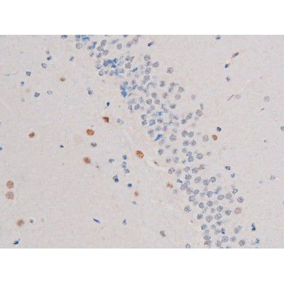 Phospho-IRS1 (Ser636) Antibody in Immunohistochemistry (Paraffin) (IHC (P))