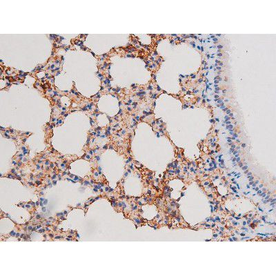 Phospho-IRS1 (Ser636) Antibody in Immunohistochemistry (Paraffin) (IHC (P))