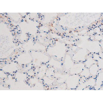 Phospho-IRS1 (Ser636) Antibody in Immunohistochemistry (Paraffin) (IHC (P))