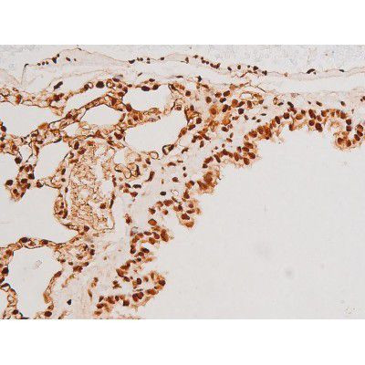 Phospho-SYK (Tyr348) Antibody in Immunohistochemistry (Paraffin) (IHC (P))