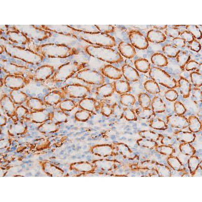 Phospho-SYK (Tyr348) Antibody in Immunohistochemistry (Paraffin) (IHC (P))