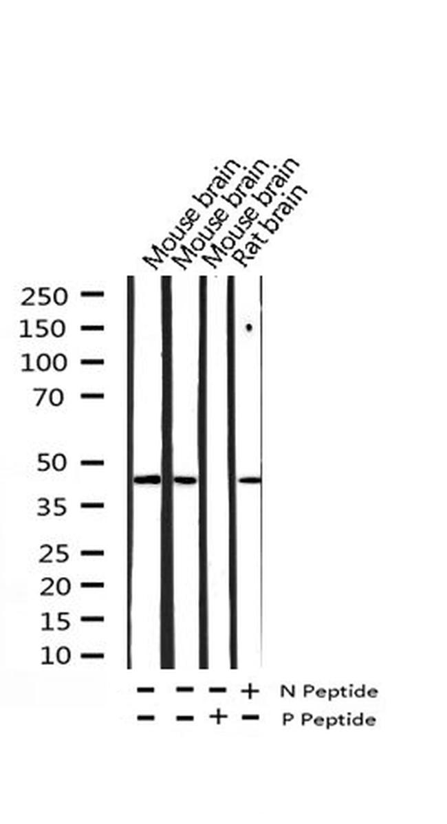 Phospho-C/EBP alpha (Ser21) Antibody in Western Blot (WB)