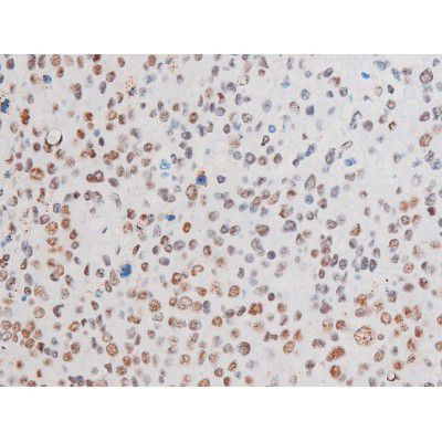 Phospho-LIMK2 (Ser283) Antibody in Immunohistochemistry (Paraffin) (IHC (P))