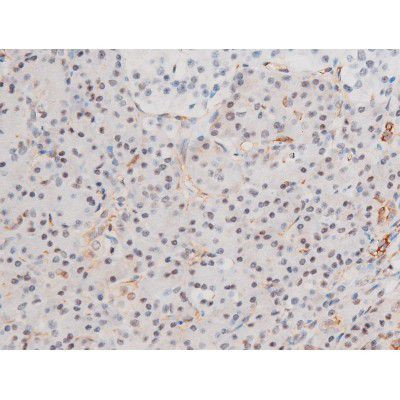 Phospho-LIMK2 (Ser283) Antibody in Immunohistochemistry (Paraffin) (IHC (P))