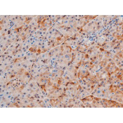 Phospho-LIMK2 (Ser283) Antibody in Immunohistochemistry (Paraffin) (IHC (P))