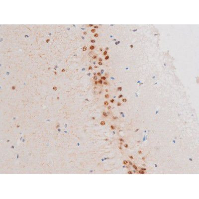 Phospho-LIMK2 (Ser283) Antibody in Immunohistochemistry (Paraffin) (IHC (P))