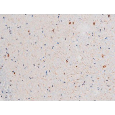 Phospho-LIMK2 (Ser283) Antibody in Immunohistochemistry (Paraffin) (IHC (P))