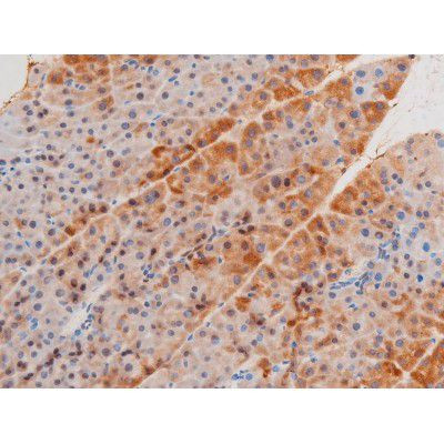 Phospho-LIMK2 (Ser283) Antibody in Immunohistochemistry (Paraffin) (IHC (P))