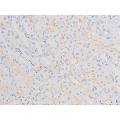 Phospho-LIMK2 (Ser283) Antibody in Immunohistochemistry (Paraffin) (IHC (P))