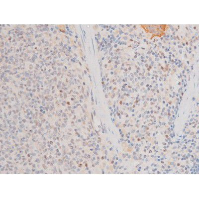 Phospho-LIMK2 (Ser283) Antibody in Immunohistochemistry (Paraffin) (IHC (P))