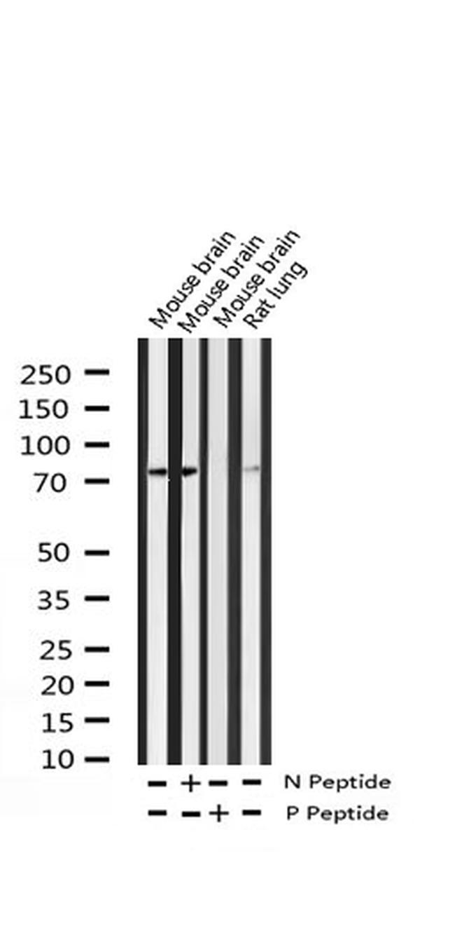 Phospho-LIMK2 (Ser283) Antibody in Western Blot (WB)