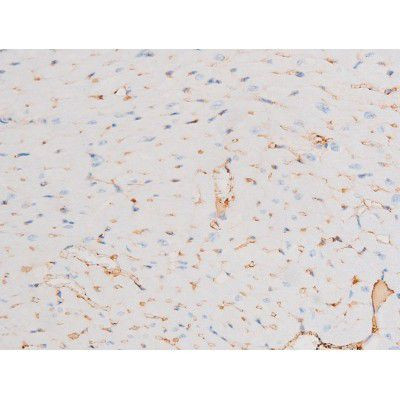 Phospho-Dynamin 1 (Ser774) Antibody in Immunohistochemistry (Paraffin) (IHC (P))