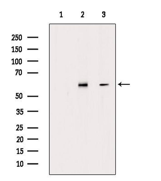 Phospho-ESR2 (Ser105) Antibody in Western Blot (WB)