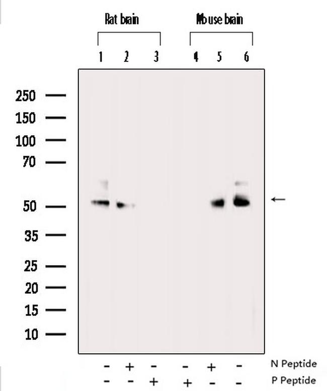 Phospho-CaMKII alpha/beta/delta (Thr305) Antibody in Western Blot (WB)