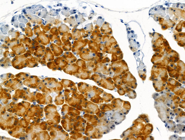 Phospho-TSC1 (Ser505) Antibody in Immunohistochemistry (Paraffin) (IHC (P))