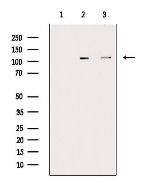 Phospho-NEDD4 (Ser670) Antibody in Western Blot (WB)