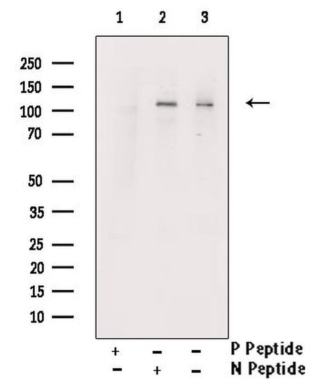 Phospho-KSR1 (Thr425) Antibody in Western Blot (WB)