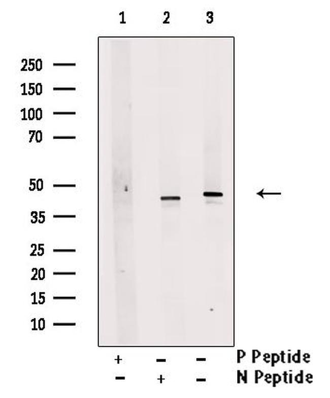 Phospho-PSMC5 (Ser120) Antibody in Western Blot (WB)