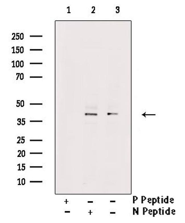 Phospho-MCL-1 (Ser64) Antibody in Western Blot (WB)