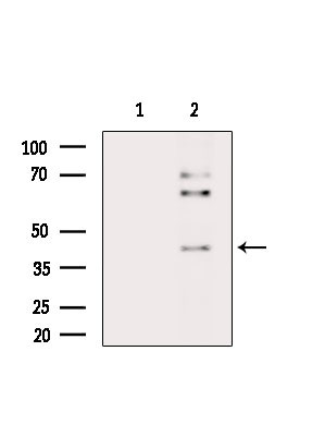 Phospho-PAR4 (Thr163) Antibody in Western Blot (WB)