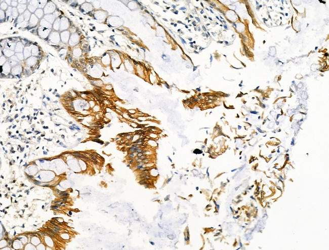 Phospho-RAD18 (Ser403) Antibody in Immunohistochemistry (Paraffin) (IHC (P))