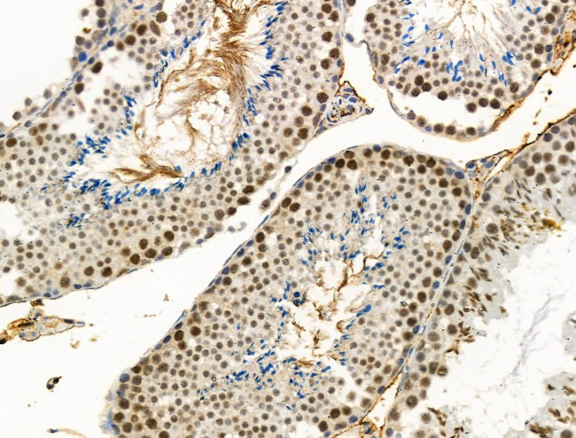 Phospho-RAD18 (Ser403) Antibody in Immunohistochemistry (Paraffin) (IHC (P))