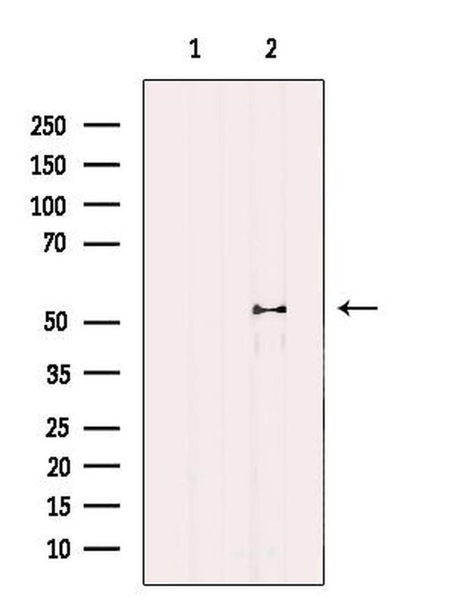 Naked Antibody Pa