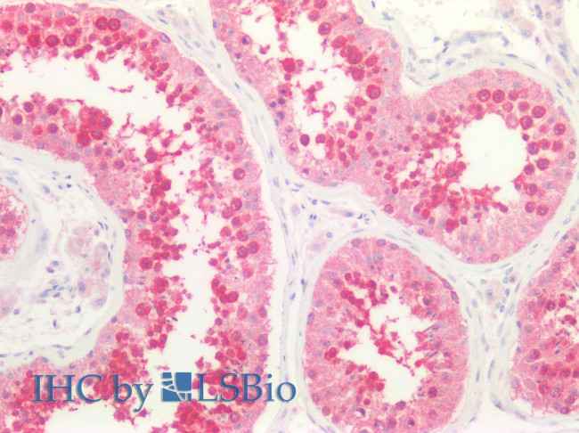 Caspase 9 (Cleaved Asp353) Antibody in Immunohistochemistry (Paraffin) (IHC (P))