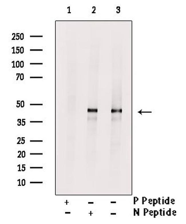 Phospho-KISS1R (Ser368) Antibody in Western Blot (WB)