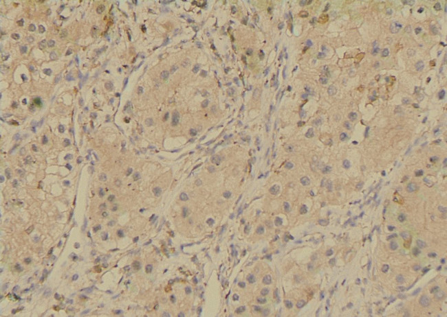 Phospho-SGLT1 (Ser335) Antibody in Immunohistochemistry (Paraffin) (IHC (P))