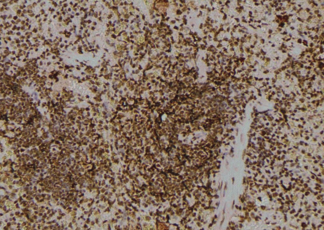 Phospho-FKBP4 (Tyr220) Antibody in Immunohistochemistry (Paraffin) (IHC (P))