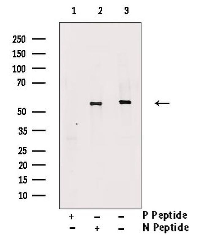 Phospho-TAB1 (Tyr481) Antibody in Western Blot (WB)