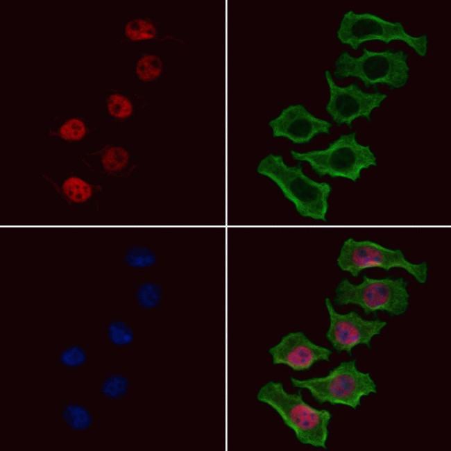 Phospho-SGTA (Ser301) Antibody in Immunocytochemistry (ICC/IF)