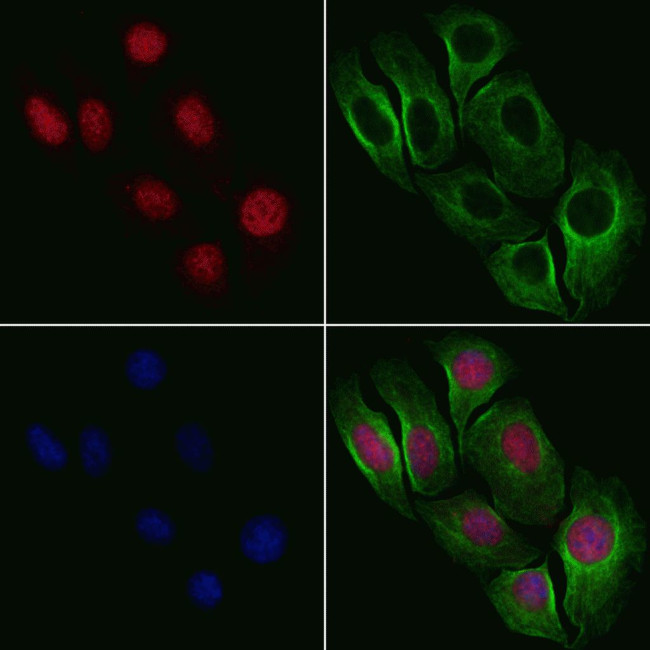 Phospho-NBS1 (Ser432) Antibody in Immunocytochemistry (ICC/IF)