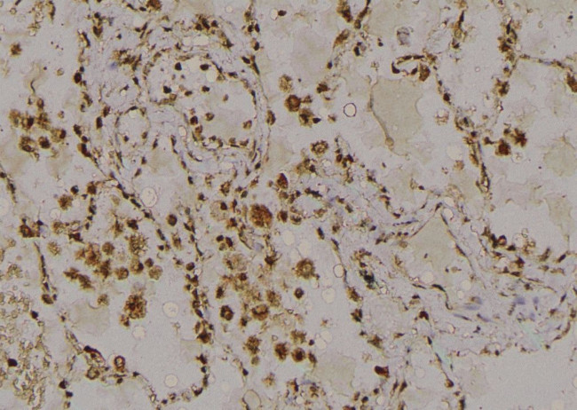 Phospho-RAD17 (Ser359) Antibody in Immunohistochemistry (Paraffin) (IHC (P))