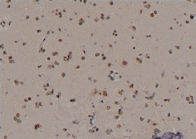 Phospho-p53 (Ser99) Antibody in Immunohistochemistry (Paraffin) (IHC (P))