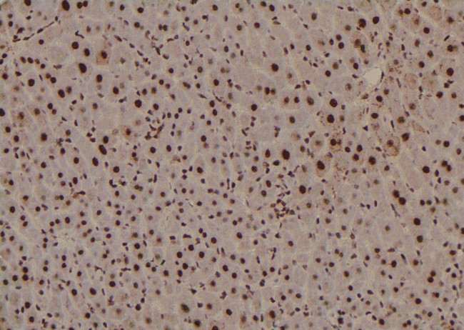 Phospho-p53 (Ser99) Antibody in Immunohistochemistry (Paraffin) (IHC (P))