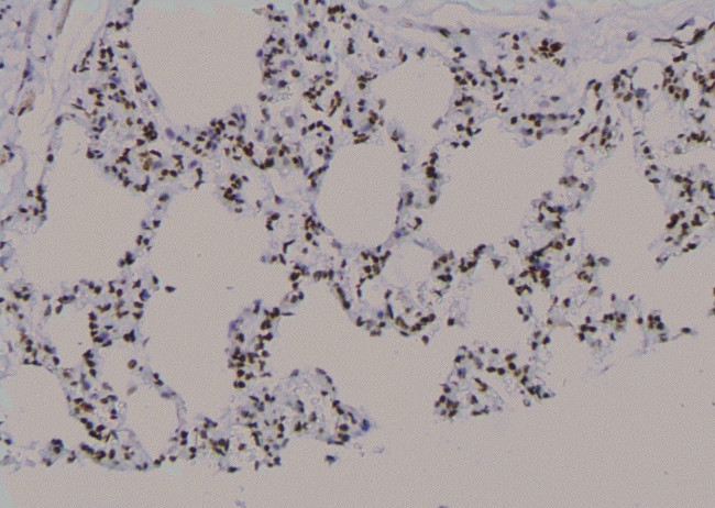 Phospho-p53 (Ser99) Antibody in Immunohistochemistry (Paraffin) (IHC (P))