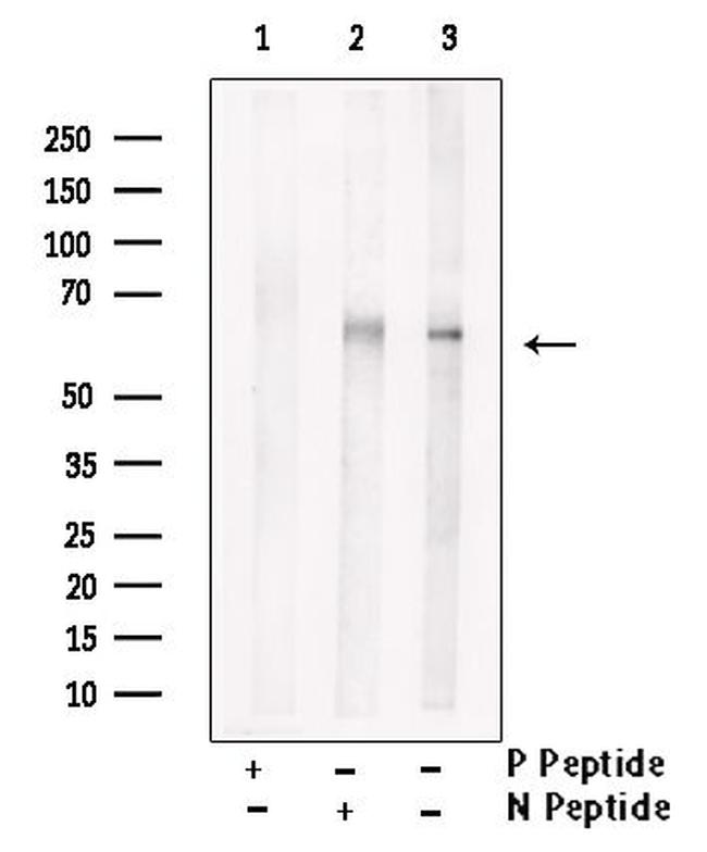 Phospho-LCK (Tyr394) Antibody in Western Blot (WB)