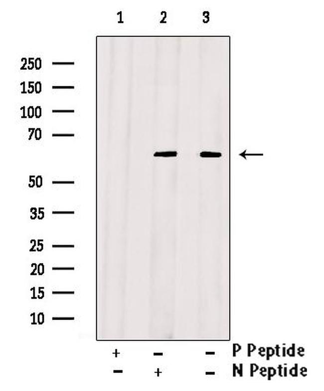 Phospho-Fyn (Tyr213, Tyr214) Antibody in Western Blot (WB)