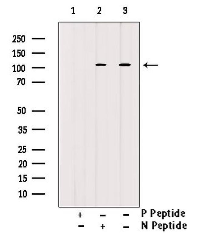 Phospho-ATP1A1 (Tyr542) Antibody in Western Blot (WB)